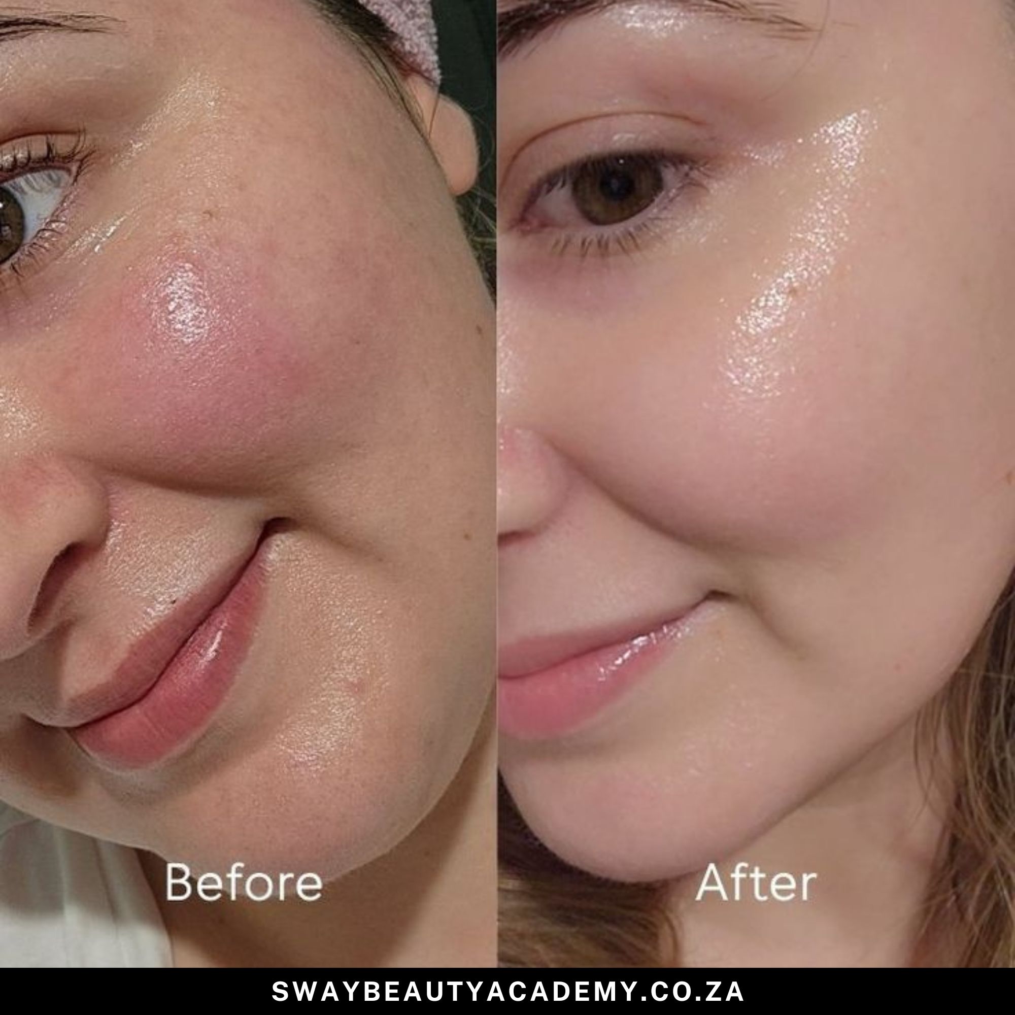 Glow Up Skincare Cheat Sheet: : 3-in-1 Fix for Acne, Dark Spots & Aging